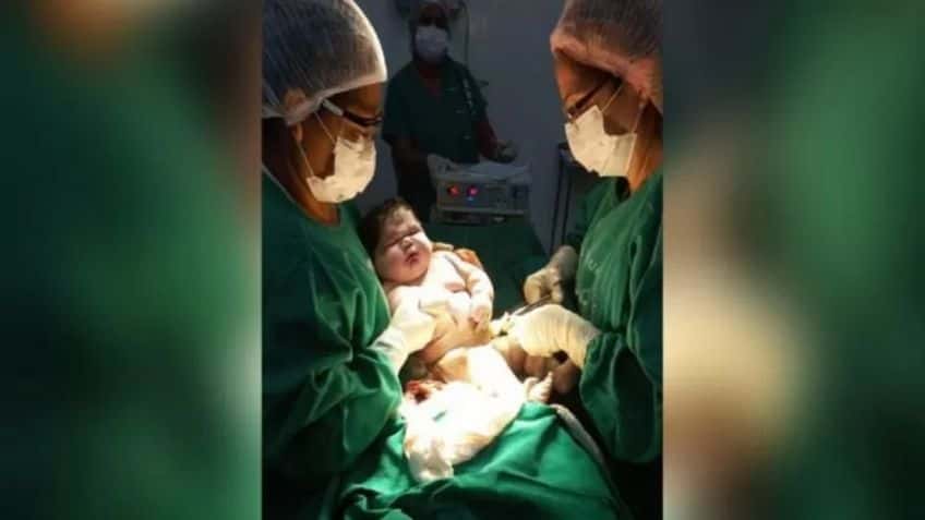 Nació un "bebé gigante" de 7,3 kg: cuáles son las causas